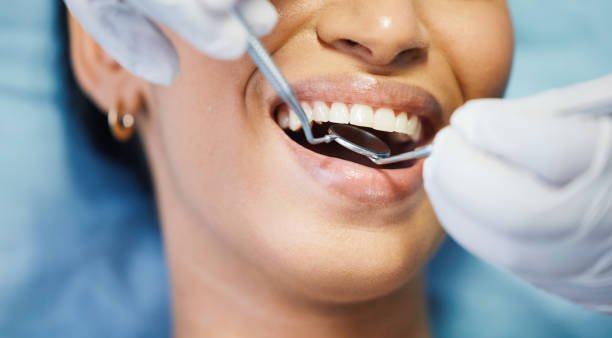 Best Emergency Root Canal Therapy in Rafter J Ranch, WY