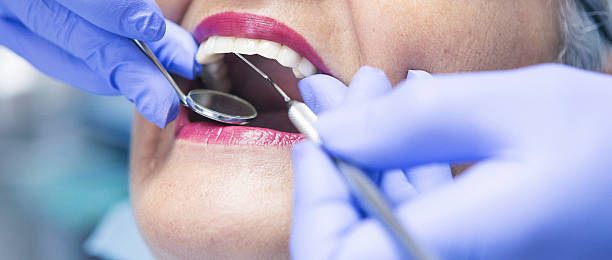 Best Emergency Cosmetic Dentistry (e.g., broken veneers) in Rafter J Ranch, WY